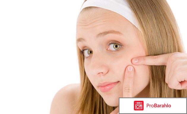 Как быстро избавиться от прыщей отрицательные отзывы