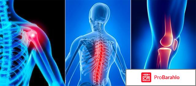 Акулий жир для суставов инструкция отрицательные отзывы