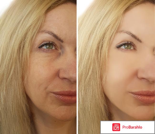 NOVA DERM - сыворотка с ботокс эффектом отзывы владельцев