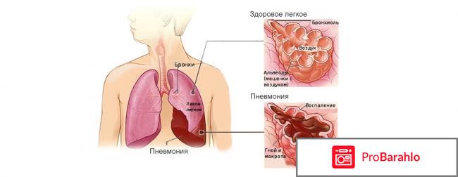 Петрович руслан юрьевич отрицательные отзывы 