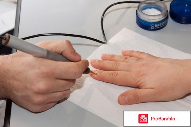 Биорезонансная диагностика отзывы обман