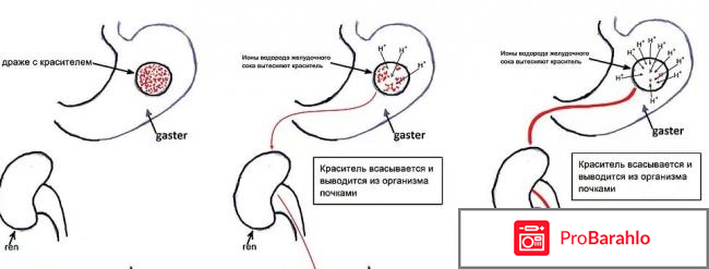 Гастрит с повышенной и пониженной кислотностью как отличить 