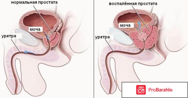 Простонор (Prostonor) - обычный обман 