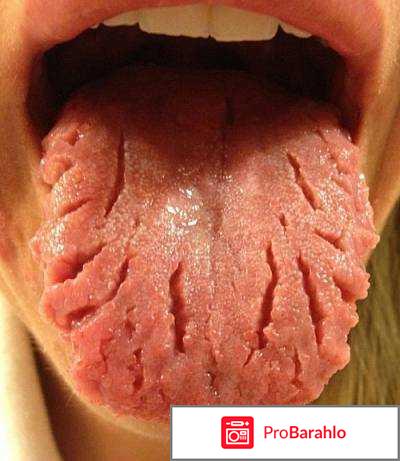 Неровный язык по краям отрицательные отзывы