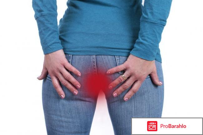 изображение Зуд в заднем проходе у женщин отзывы