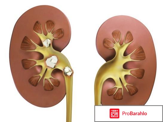 Чистка кишечника обман