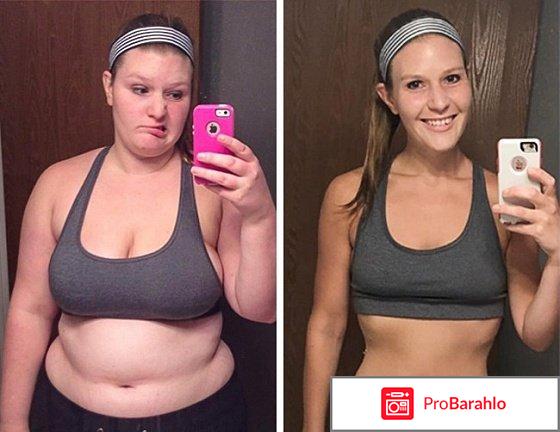 Редуксин 15 мг отзывы худеющих с фото обман