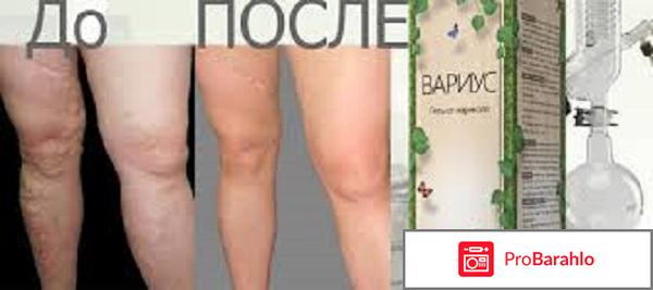 Вариус отзывы покупателей обман