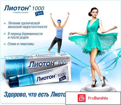 Гели от варикоза на ногах 