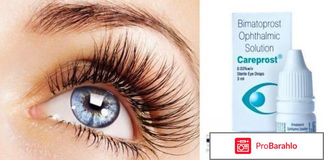 Карепрост для ресниц отзывы фото 