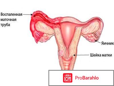 Узи маточных труб на проходимость 