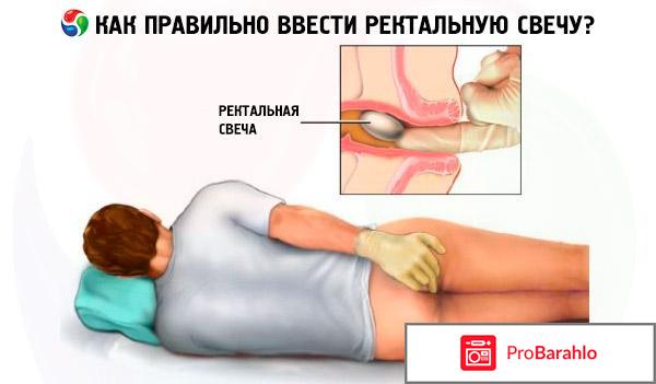 Свечи облепиховые отзывы владельцев