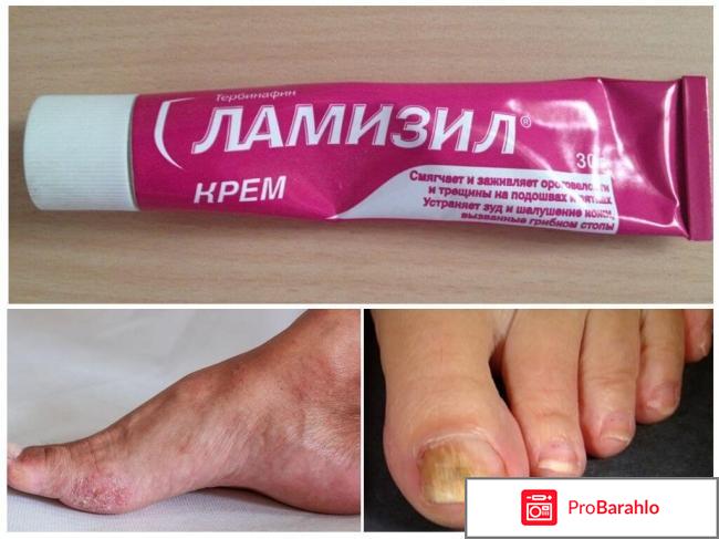 Ламизил мазь инструкция цена отзывы украина 
