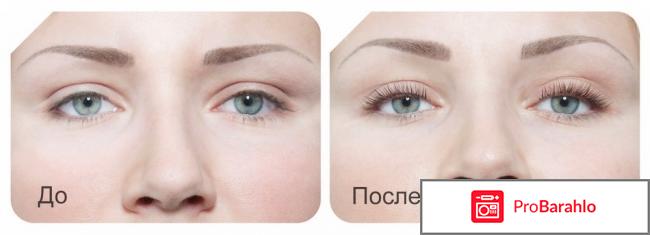 Ламинирование ресниц отзывы врачей обман