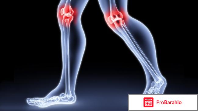 Артрозилен гель инструкция по применению цена отзывы реальные отзывы