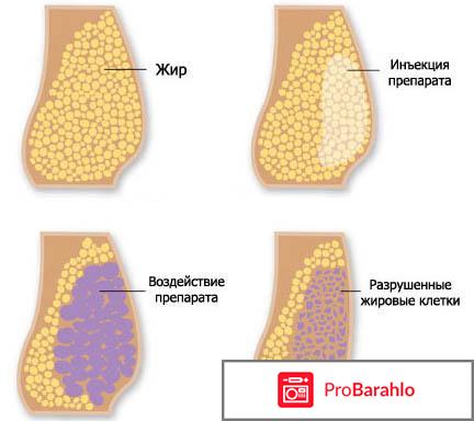 Инъекции для похудения отзывы реальные отзывы