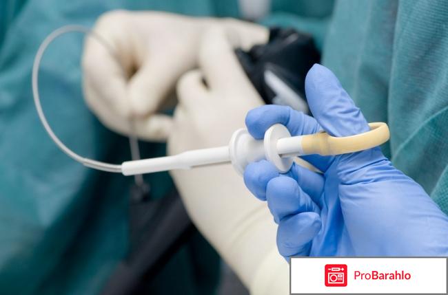 Пайпель биопсия эндометрия отрицательные отзывы