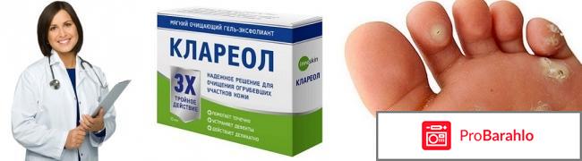Клареол гель отзывы отрицательные отзывы
