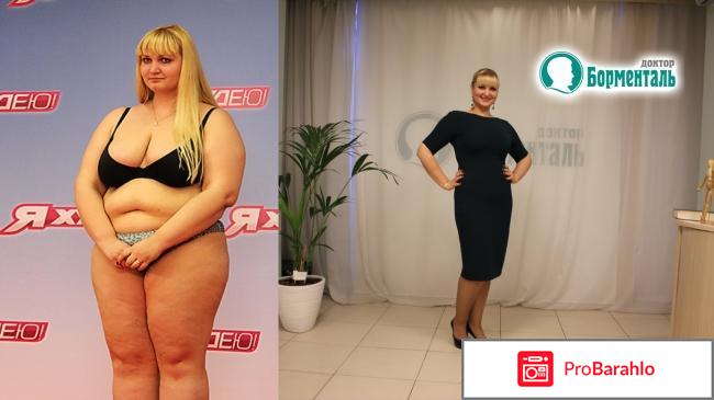 Пластика живота фото обман