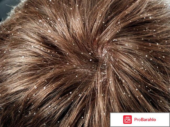 Кетоконазол шампунь обман