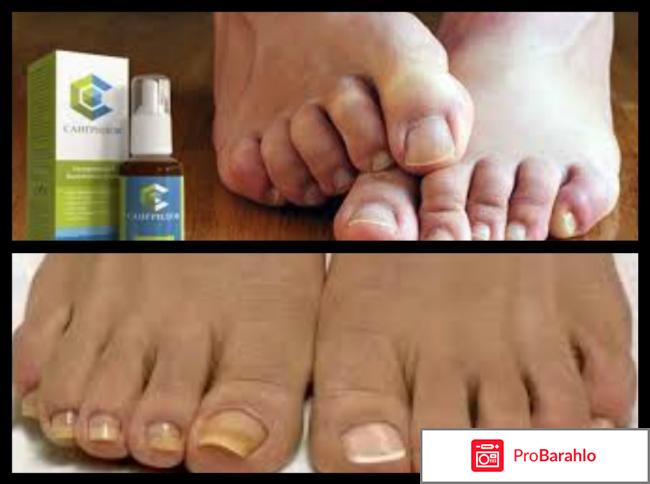 Сангридок реальные отзывы цена 