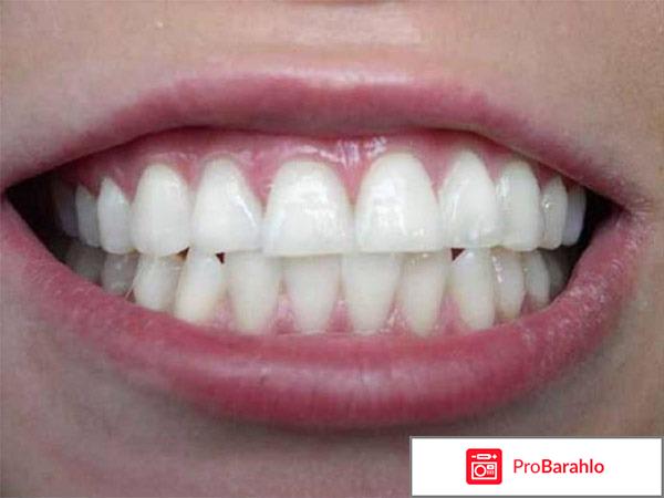 Зум 3 отбеливание отрицательные отзывы