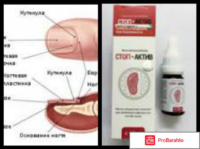 Масло стоп актив отзывы форум отрицательные отзывы