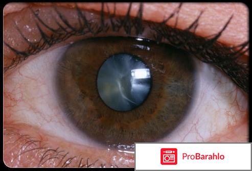 Каталин глазные капли отзывы форум отрицательные отзывы