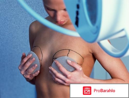 Отзывы после маммопластики отрицательные отзывы