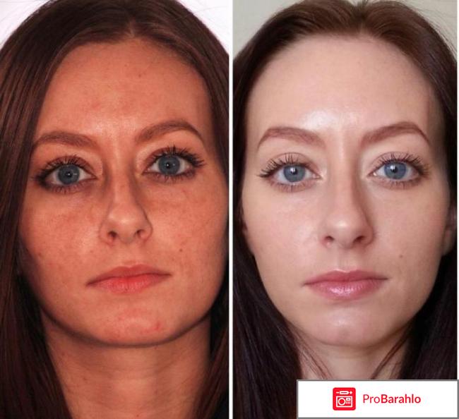 Miracle glow отбеливающая маска для лица 