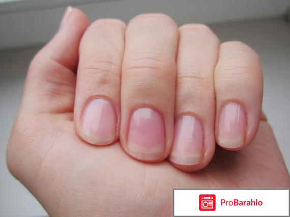 Микодерил от грибка ногтей отзывы цена обман