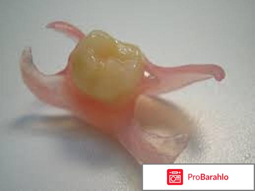 Зубной протез бабочка 