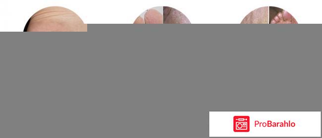 Стоп Актив от грибка отзывы владельцев