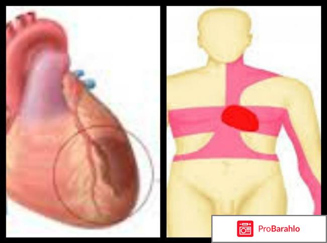 Загрудинная боль — 6 причин отрицательные отзывы