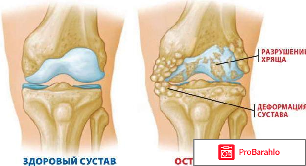Диафлекс инструкция по применению цена отзывы таблетки отрицательные отзывы