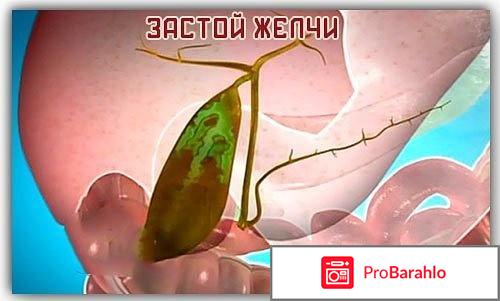 Холензим отзывы врачей отрицательные отзывы