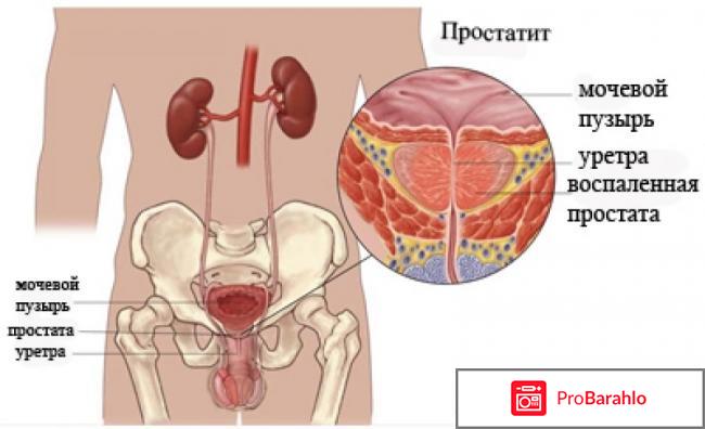 Простодин капли от простатита отрицательные отзывы