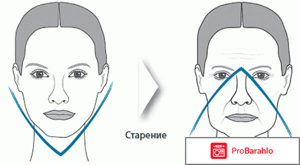 Радиесс отзывы фото до и после цена обман