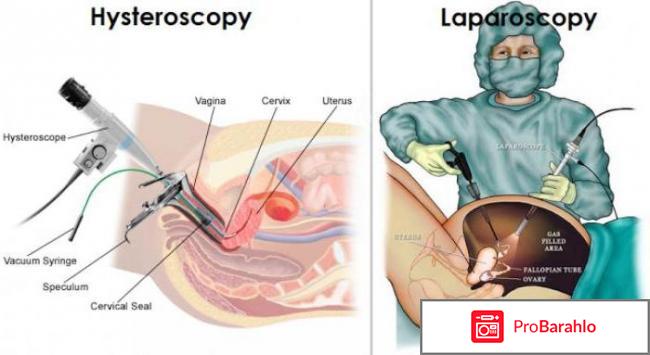 Гистероскопия в спб отзывы отрицательные отзывы