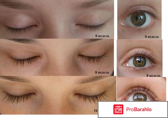 Карепрост отзывы врачей обман