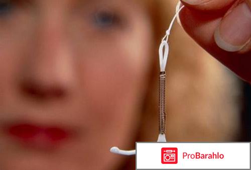 Мирена отзывы женщин после 50 обман