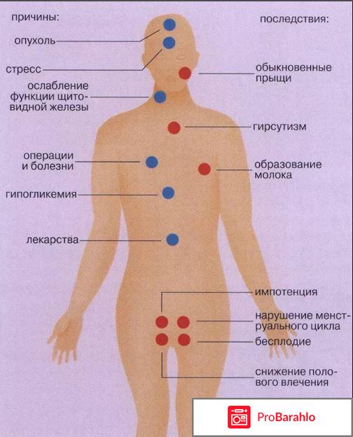 Повышенный пролактин у женщин: причины, признаки 