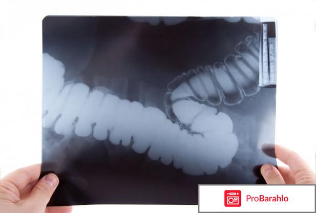 Как проверить кишечник кроме колоноскопии 