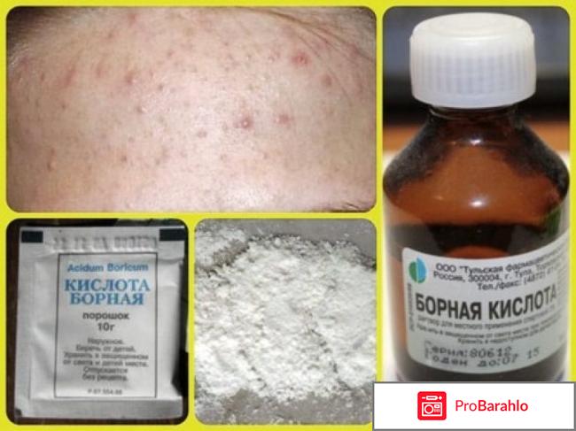 Борная кислота реальные отзывы