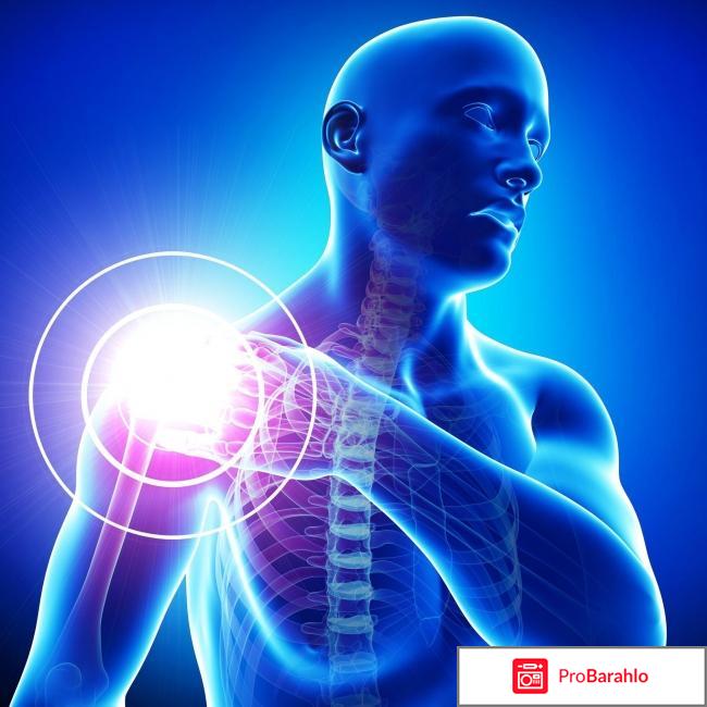 Хондроглюксид 