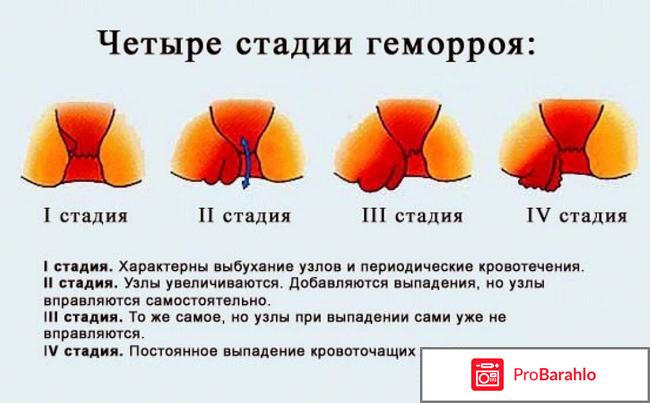 Анестезол свечи отзывы отрицательные отзывы