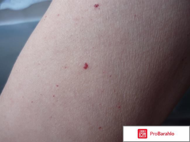 Капилар инструкция по применению отзывы врачей фото