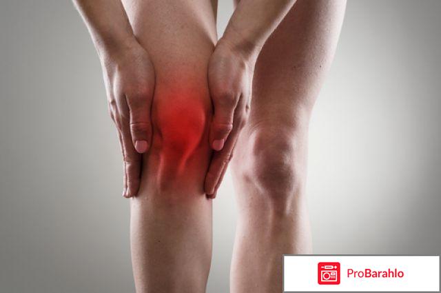 Хондроглюксид цена отзывы аналоги обман