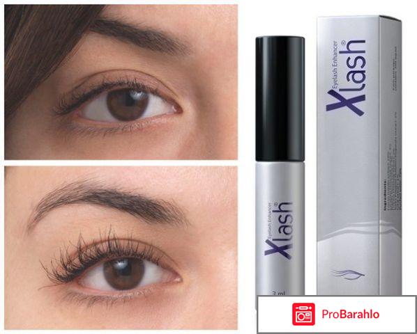 Almea Xlash сыворотка для роста ресниц 