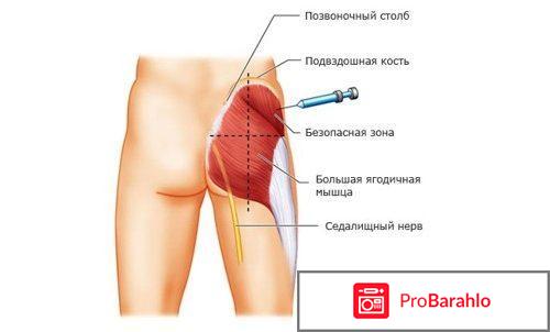 Калмирекс уколы инструкция по применению цена отзывы аналоги 